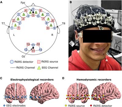 Multimodal resting-state connectivity predicts affective neurofeedback performance